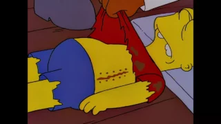 Attendez un peu. La cicatrice d'Hugo est du mauvais côté.